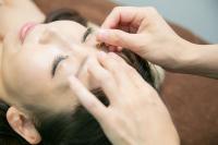 ささない美容鍼