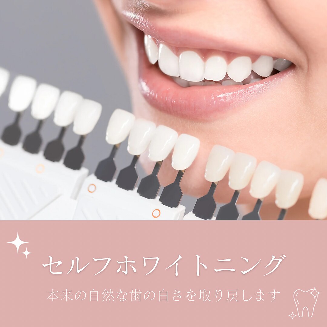 ホワイトニング