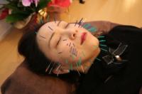 『特別な美容鍼』が気になる方へ