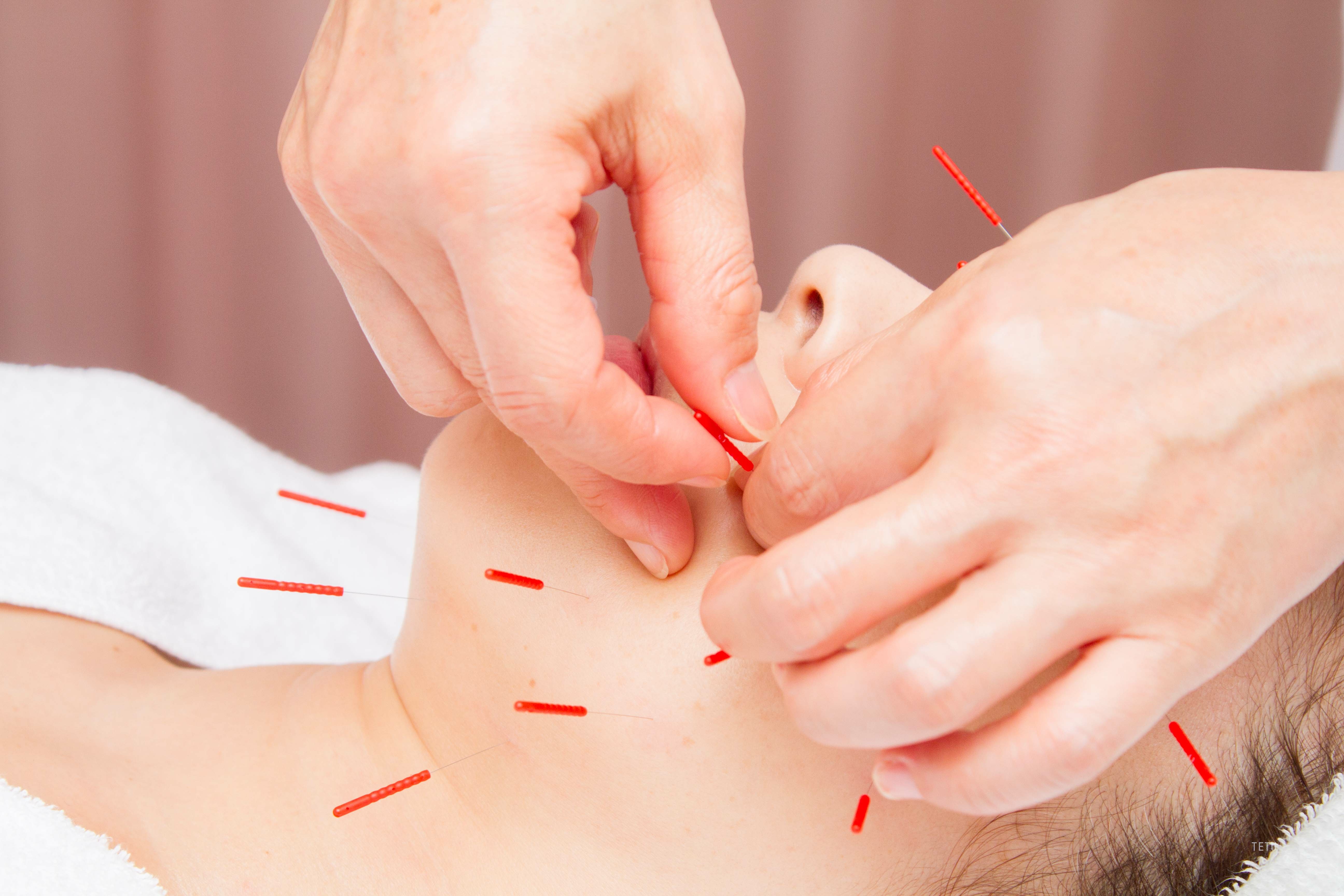 美容鍼灸メニュー