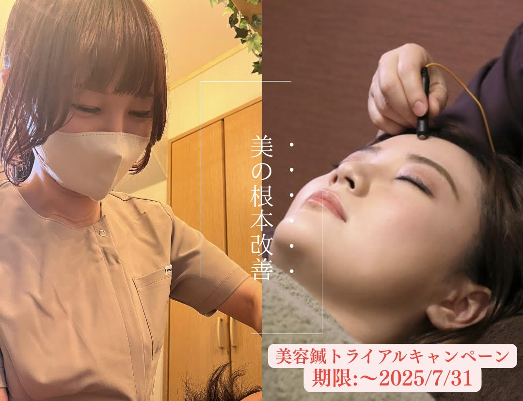 美容鍼トライアルコース