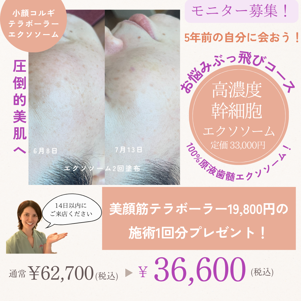 2周年祭開催！【モニター募集！エクソソームとコルギ・美顔筋テラボーラーを超お得に試すチャンス】