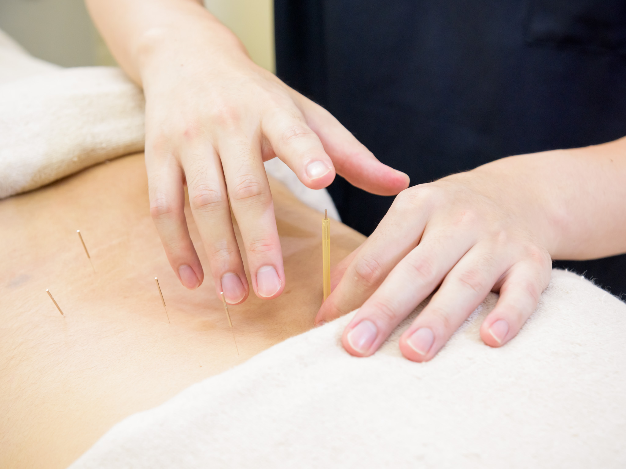 鍼治療メニュー