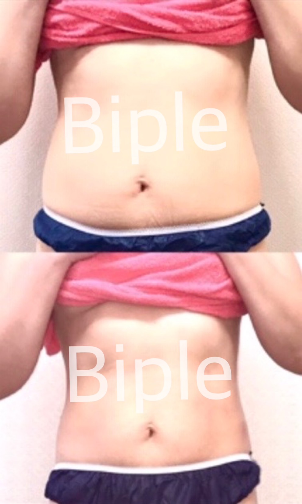 【新規】最新脂肪冷却★1カップ