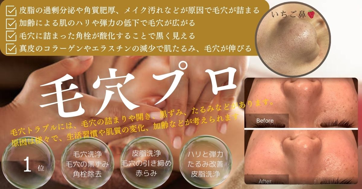 毛穴ケア洗浄吸引/開き・汚れ・皮脂・イチゴ鼻/お肌のREメンテ