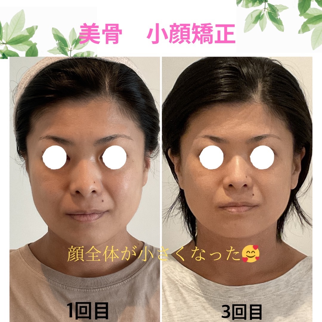 新規限定クーポン ＊美容矯正整体 　美整骨　美整法 ＊身体の歪み改善　トータルバランス矯正