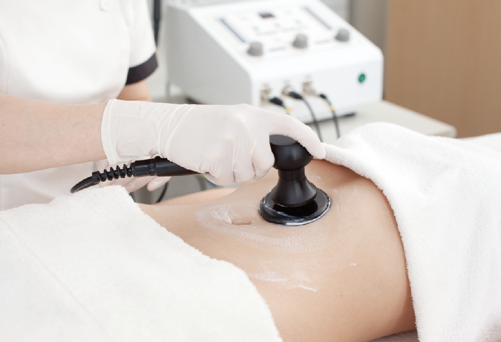 キャビテーション（女性ｽﾀｯﾌが担当します）2025/12/1-